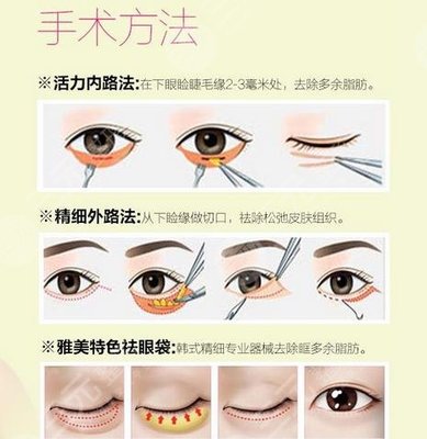 去眼袋法令纹的有效产品是什么，去眼袋方法有哪几种