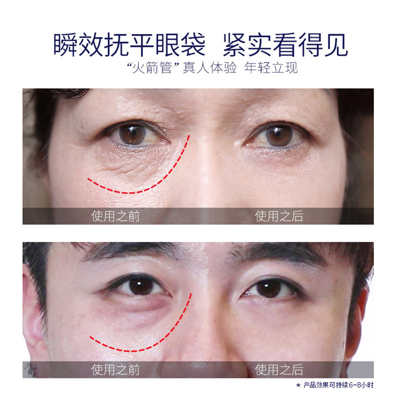 去眼袋神器真的能去眼袋吗图片大全，去眼袋神器真的有用吗